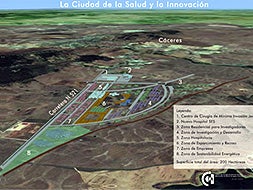 Boceto del proyecto de la CIudad de la Salud y la Innovación que se exhibe ya en el Centro de Cirugía de Mínima invasión, tal como lo gestó.|HOY/