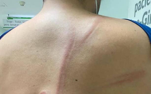 La Comunidad de Labradores pide la dimisión de García Seco por la «execrable» carga policial en Don Benito