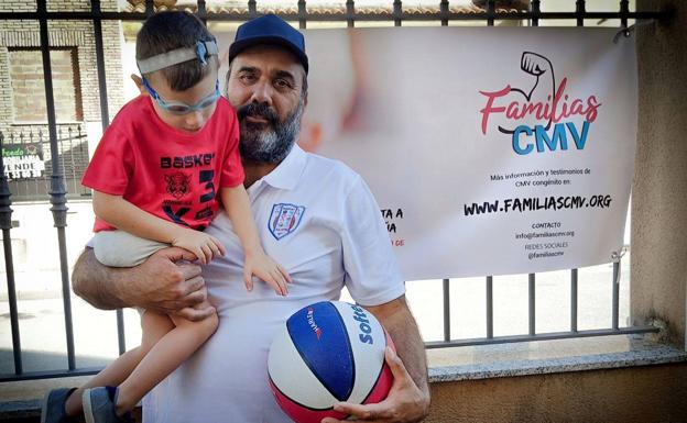 El 3X3 local destinará sus beneficios a la lucha contra el citomegalovirus