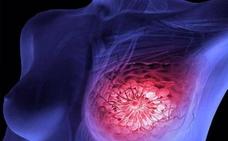 857 mujeres empiezan hoy a hacerse mamografías de prevención