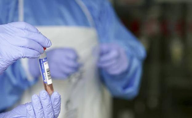 Nuevo pico de contagios con 30 casos activos