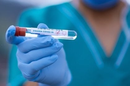 La Zarza se encuentra desde el pasado lunes libre de covid
