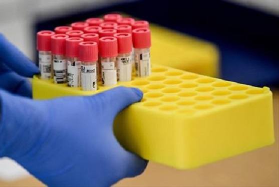 Miajadas vuelve a alcanzar los 40 casos activos