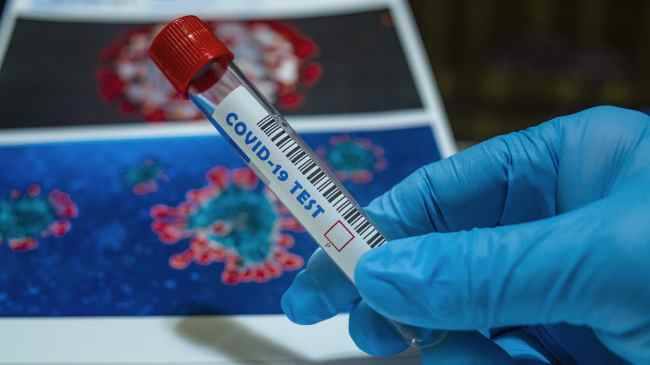 La incidencia de casos acumulados a 14 días en Miajadas aumenta a 420 casos