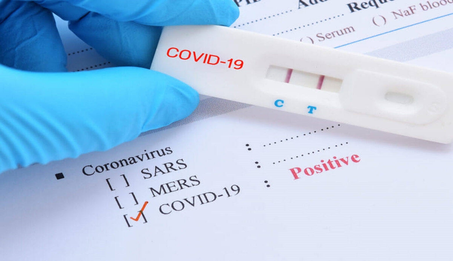 Miajadas registra dos nuevos positivos por Covid-19