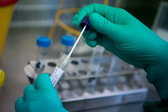Miajadas comienza la semana con 12 contagios y 7 altas por covid