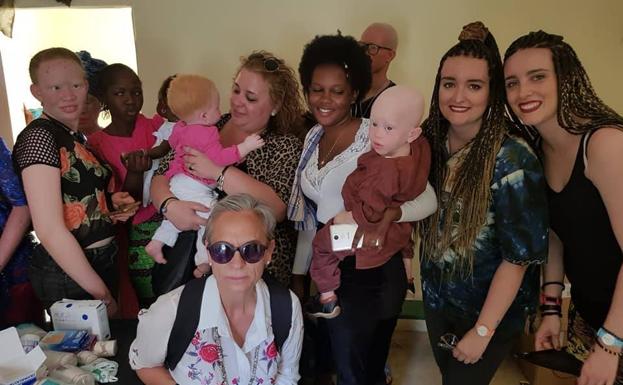 Super África Extremadura cooperará con un centro de albinos de Senegal