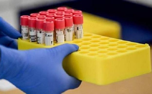 El Área de Salud notifica un positivo en Almaraz