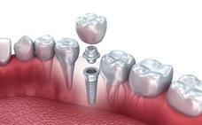 Contraindicaciones para hacerse un implante dental
