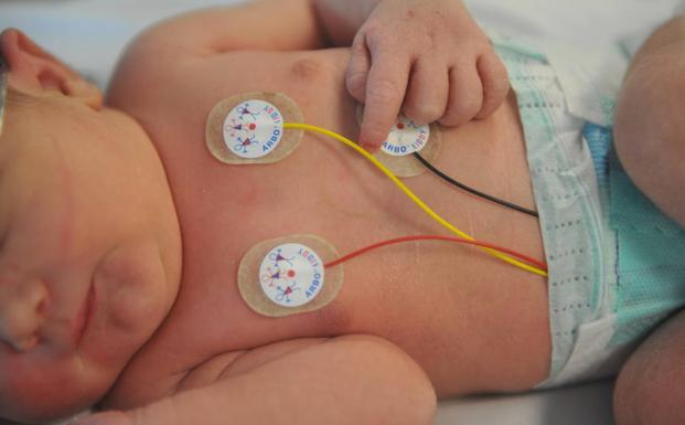 El milagro de una bebé extremeña llamada Carla