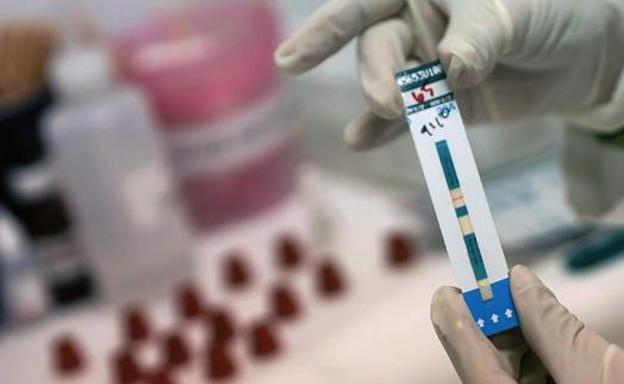 Luz verde en Extremadura al plan sobre el VIH, dotado con 53 millones hasta 2020