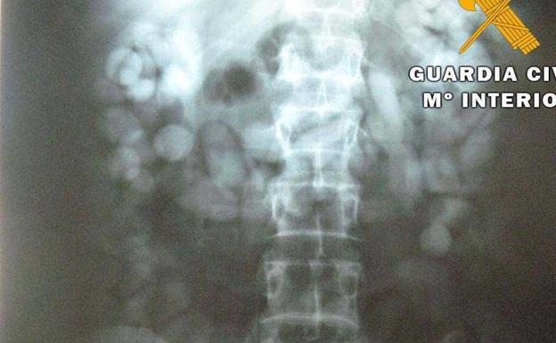 Detenido un extremeño con 216 bellotas de hachís en el interior de su cuerpo