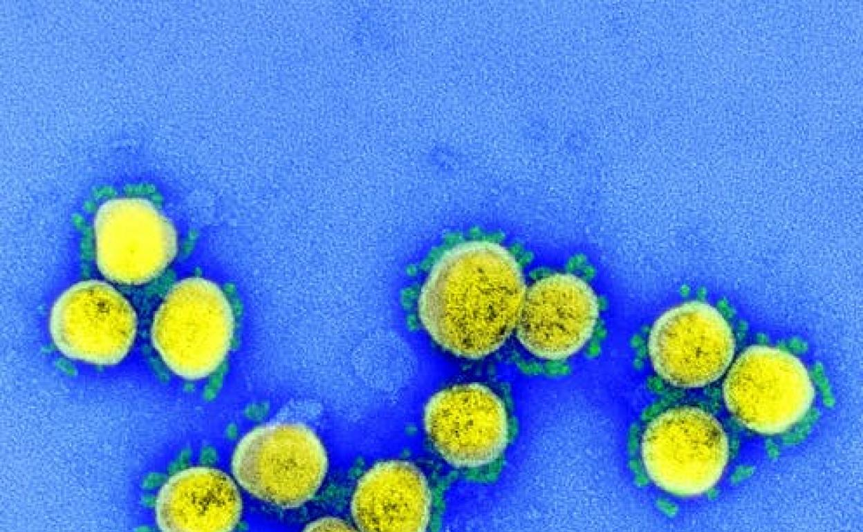 En un laboratorio recrean los primeros pasos del VIH cuando ataca un organismo humano