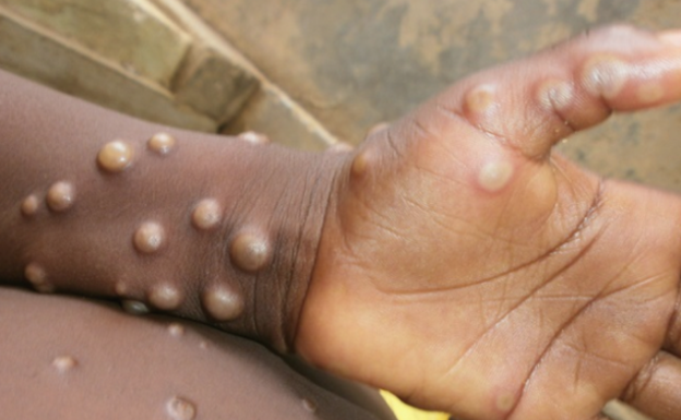 Lea las cinco noticias principales de este viernes, 20 de mayo de 2022