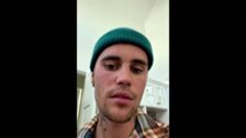 Justin Bieber revela que sufre una parálisis parcial de su rostro por un virus