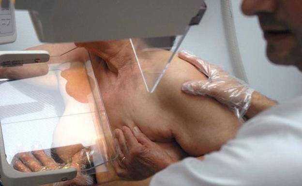 El Programa de Detección Precoz del Cáncer de Mama llega a Calamonte