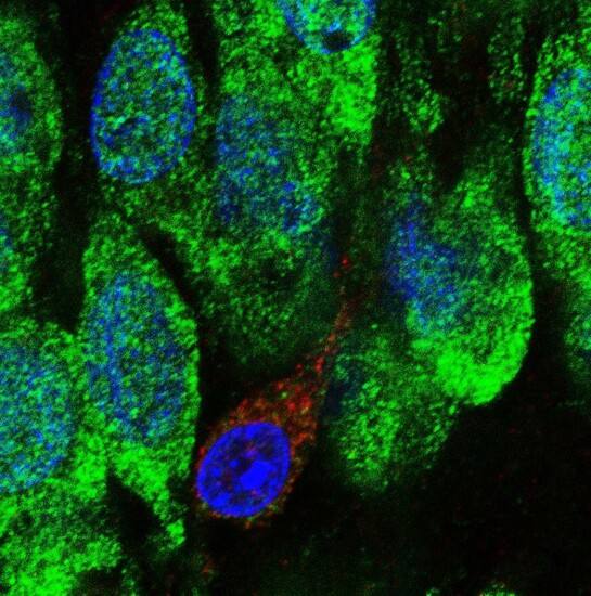 El CSIC desarrolla unas biocápsulas que atacan genéticamente a los tumores sólidos