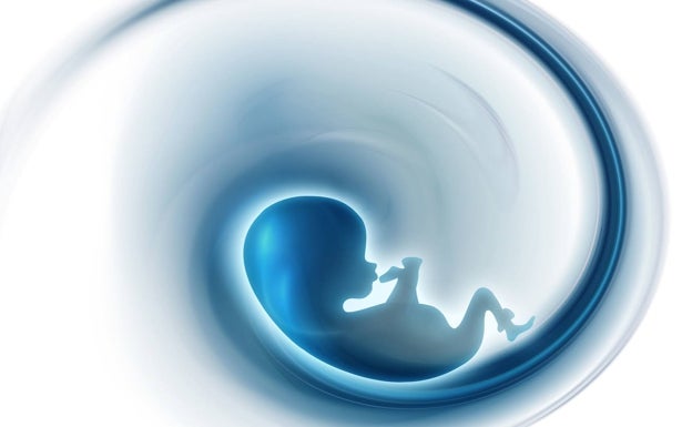 El aborto es constitucional