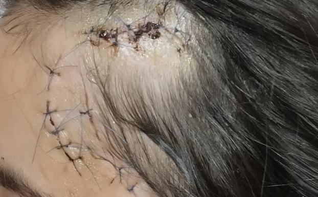 Se busca a la persona que lanzó un vaso de cristal e hirió a una menor en Talavera