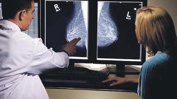 Casi 6.000 extremeñas se someterán a mamografías en julio dentro del Programa de Detección Precoz del Cáncer de Mama