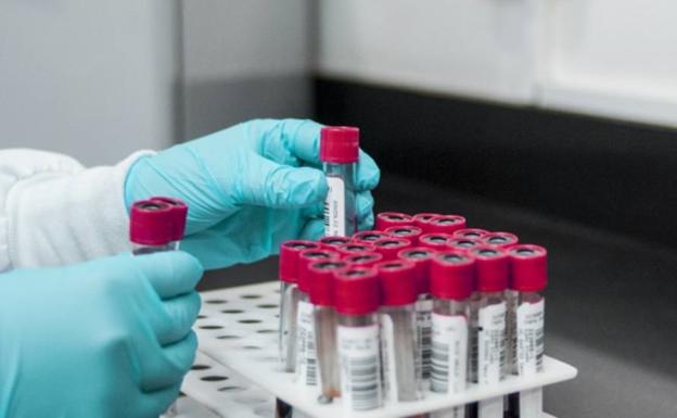 Nuevo record de contagios de covid tras notificarse 55 casos positivos en un solo día